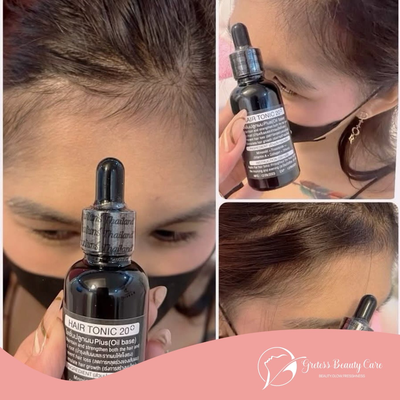 Minoxidil 20% By Fairy God Barbie - Image 2